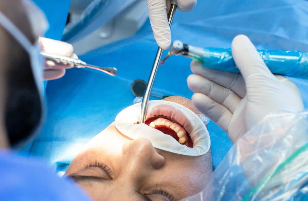 Chirurgie dentaire